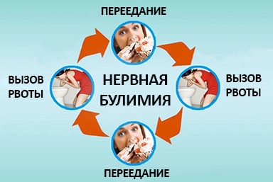 Лечение булимии в Барыше
